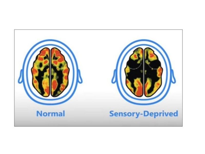 MRI brain scan infographic showing structural changes linked to screen time in children ages 3–10, with cortex and white matter regions highlighted