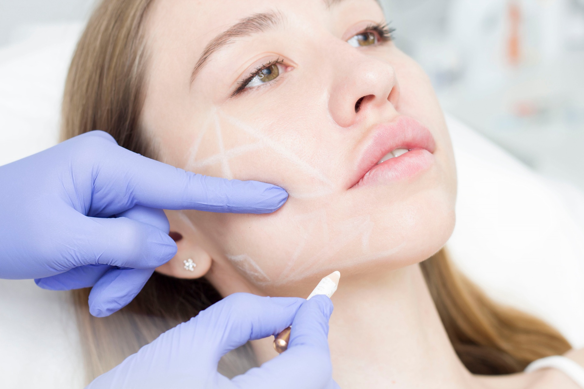 Botox for TMD in Oakland 