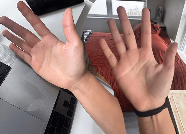before & after comparison of hand sweat