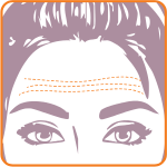Illustration of a woman's upper face with dashed lines indicating forehead wrinkles.
