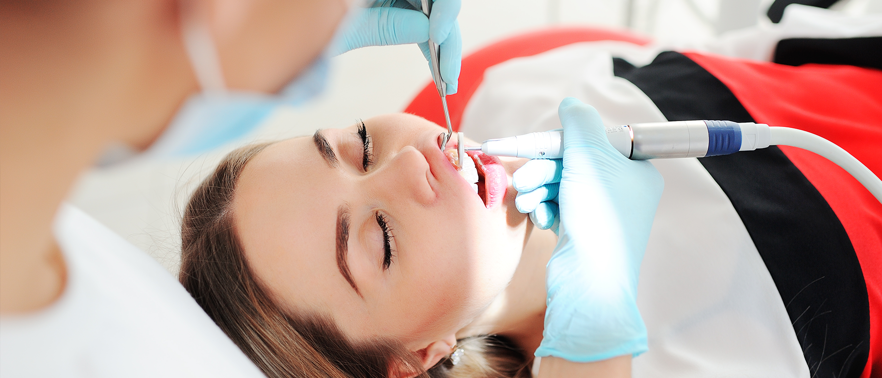 Tooth Filling