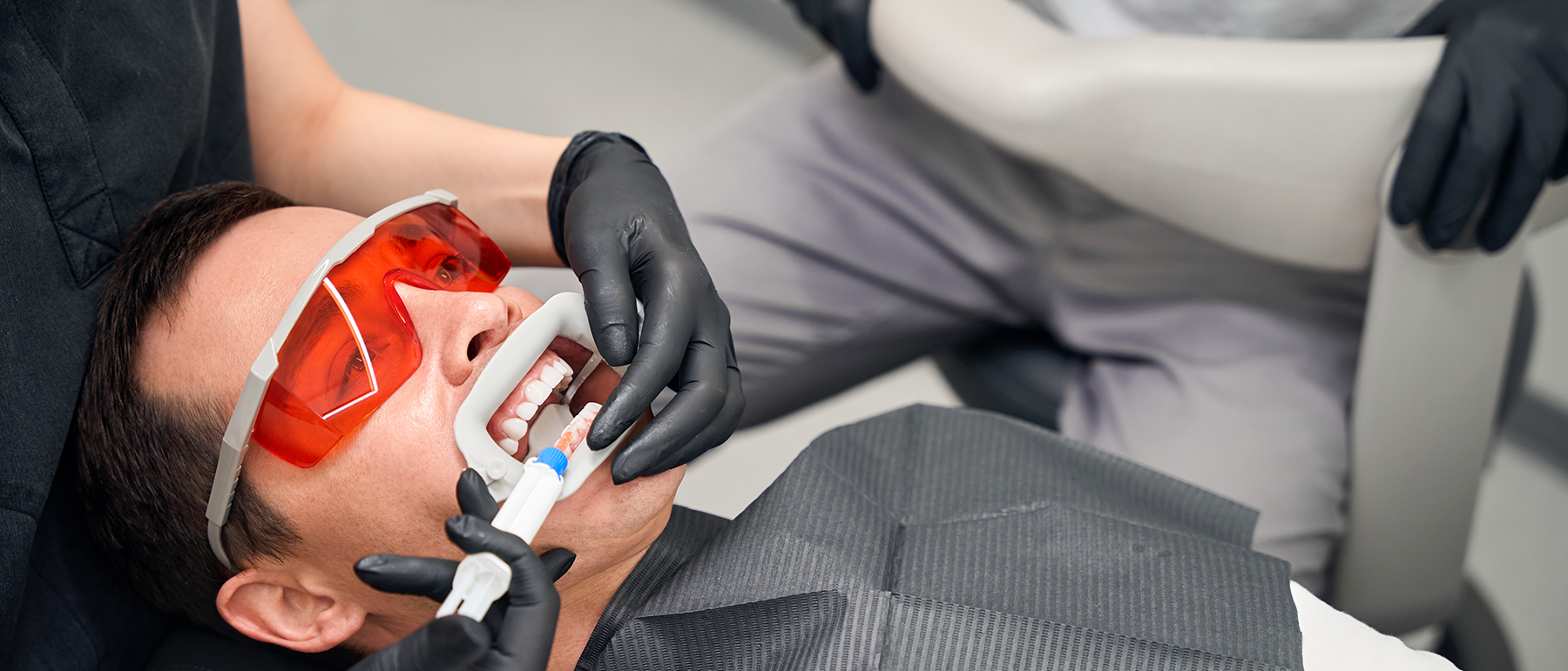 Dental Scale & Clean