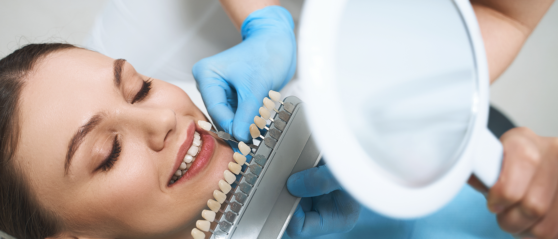 Dental Veneers
