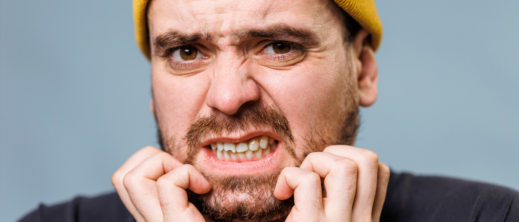 Dental Chips & Broken Teeth