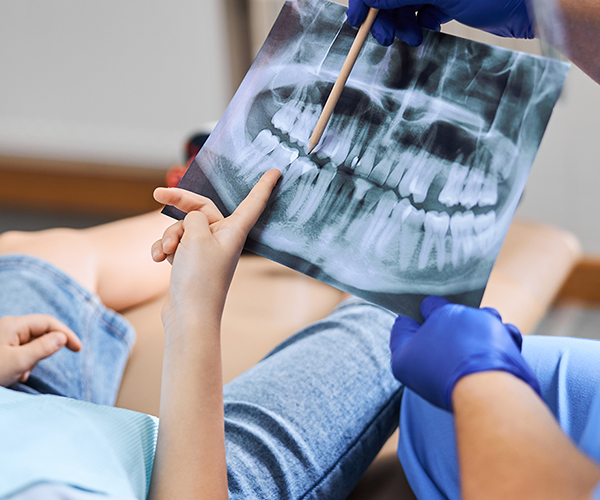 Dental X-Rays