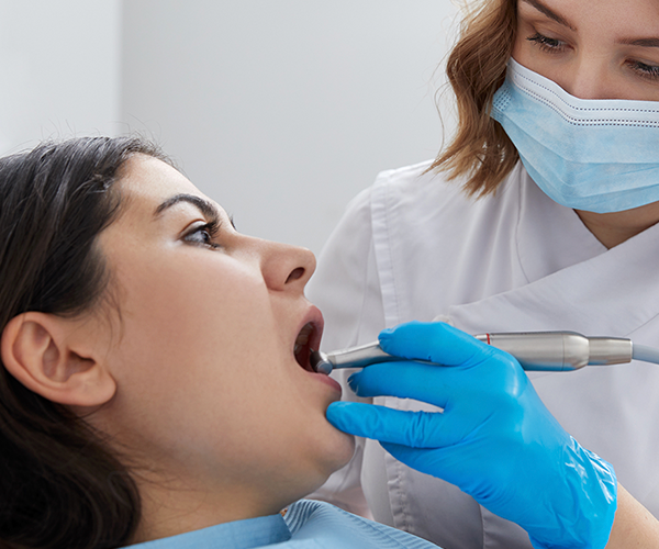 Dental Scale & Clean