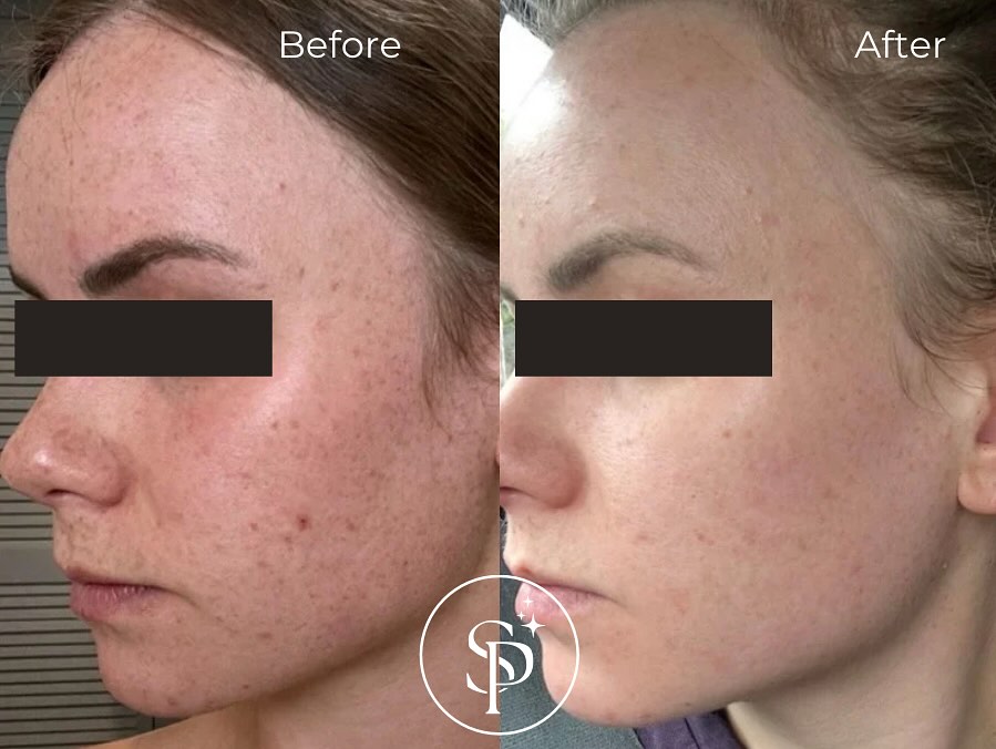 Skincare