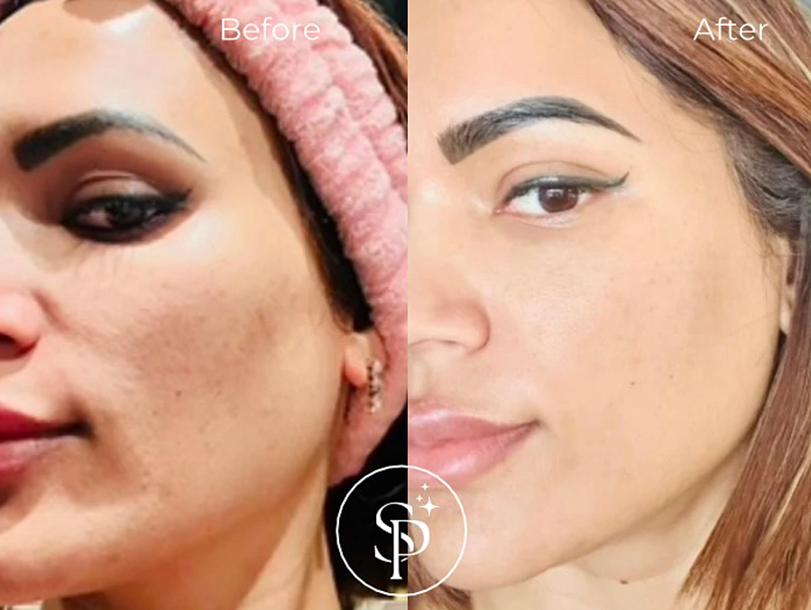 Skincare