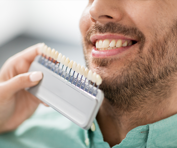 The Truth And Myths About Dental Veneers