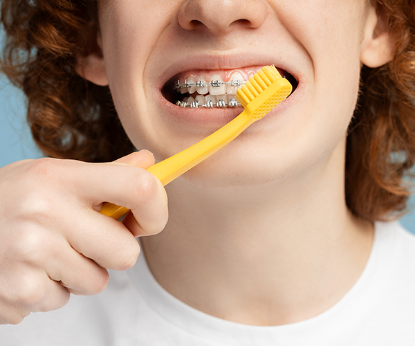 How To Brush Your Teeth With Braces