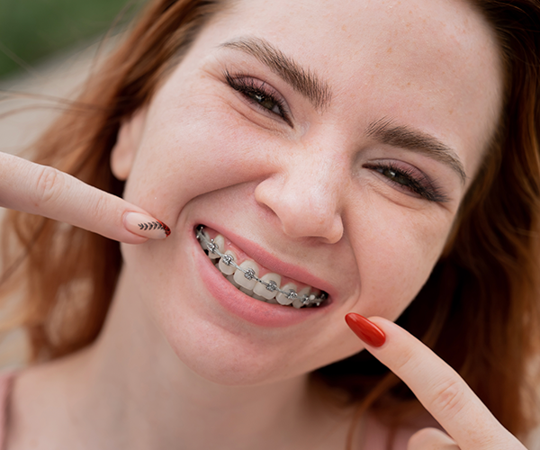Fastbraces – All You Need To Know