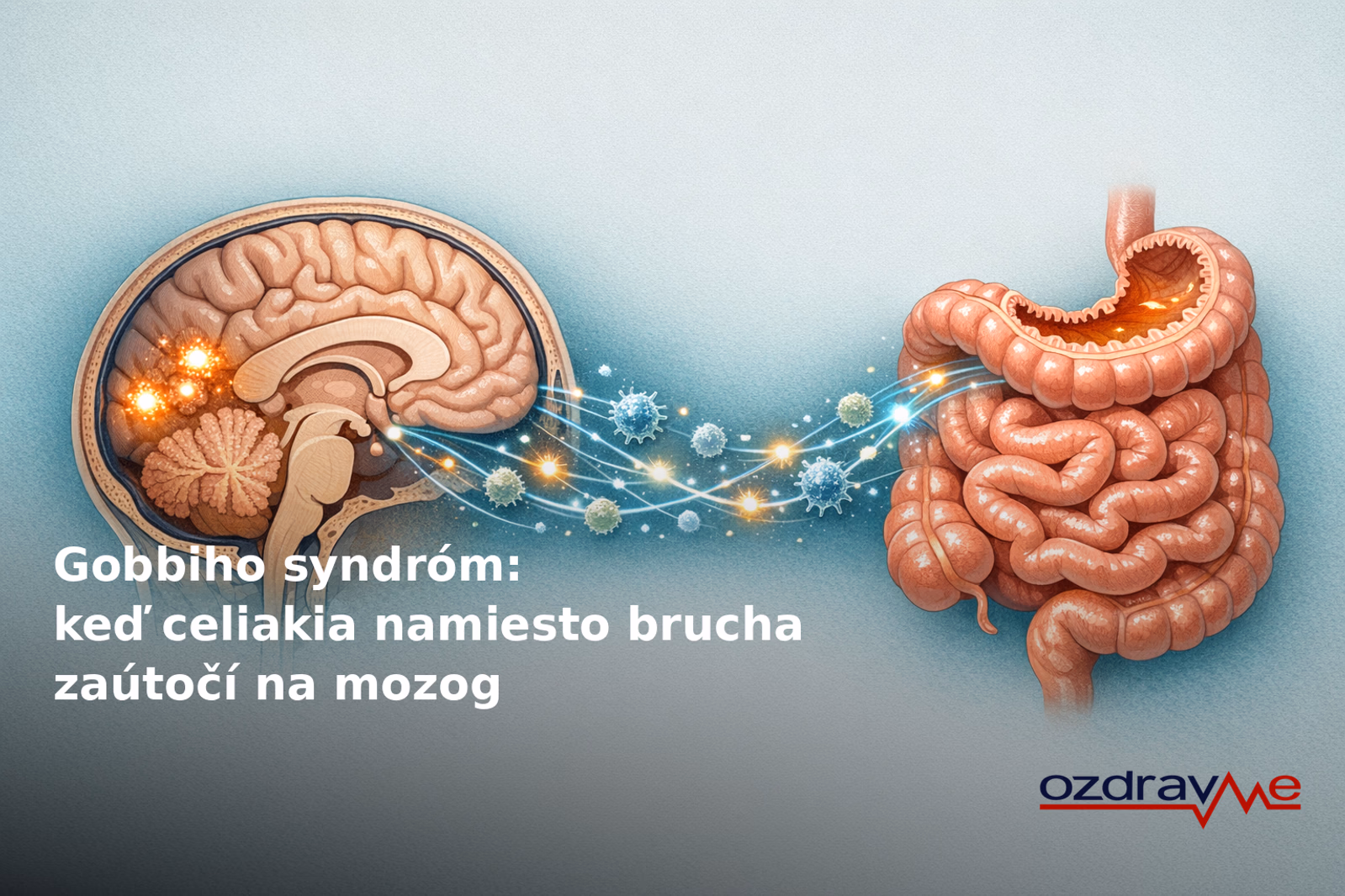 Ilustrácia Gobbiho syndrómu — prierez ľudským mozgom so žiariacimi kalcifikátmi v okcipitálnom laloku, prepojený imunitnými bunkami s tráviacou sústavou. Gobbiho syndróm je vzácna forma celiakie, pri ktorej imunitná reakcia z tenkého čreva zasahuje mozog — tvoria sa v ňom vápenaté usadeniny, ktoré môžu vyvolávať epileptické záchvaty. Lekári Fakultnej nemocnice AGEL Skalica tento syndróm diagnostikovali ako prvý zaznamenaný prípad na Slovensku.