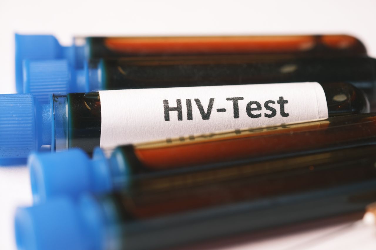 HIV krvný test
