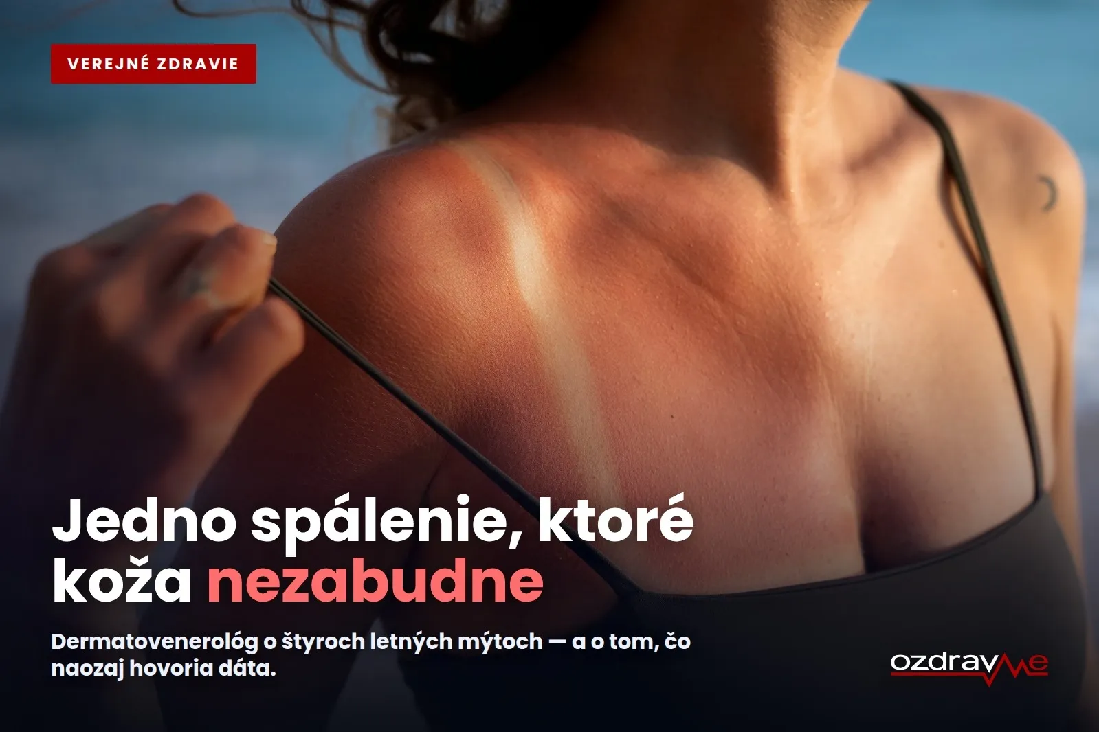 Detail spálenej pokožky ramena s výrazným začervenaním, vizuálne ukotvenie hlavnej tézy, že viditeľné poškodenie zmizne, no stopa v DNA buniek ostáva.
