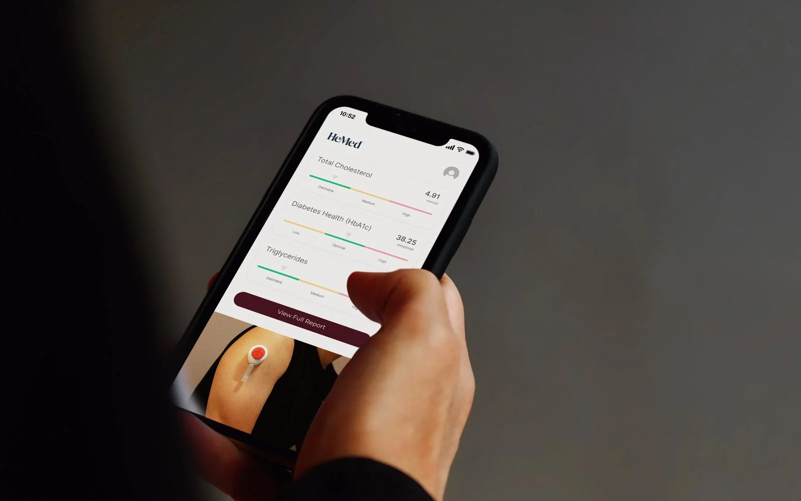 HeMed app in hand showing verified biomarker results for cholesterol, HbA1c and triglycerides