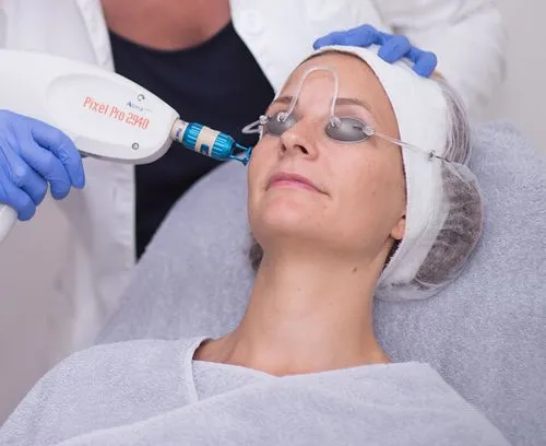 Wat is melasma?