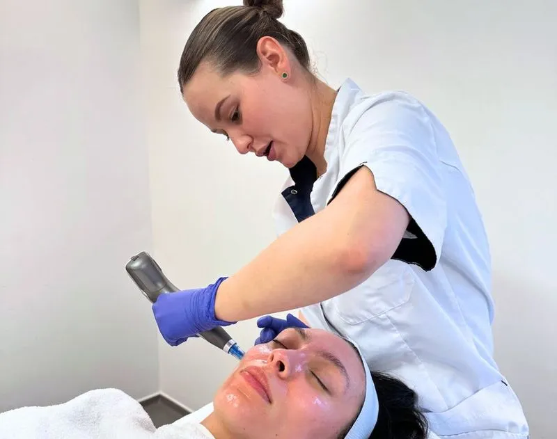 Microneedling behandeling