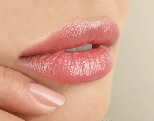 Lippen opvullen