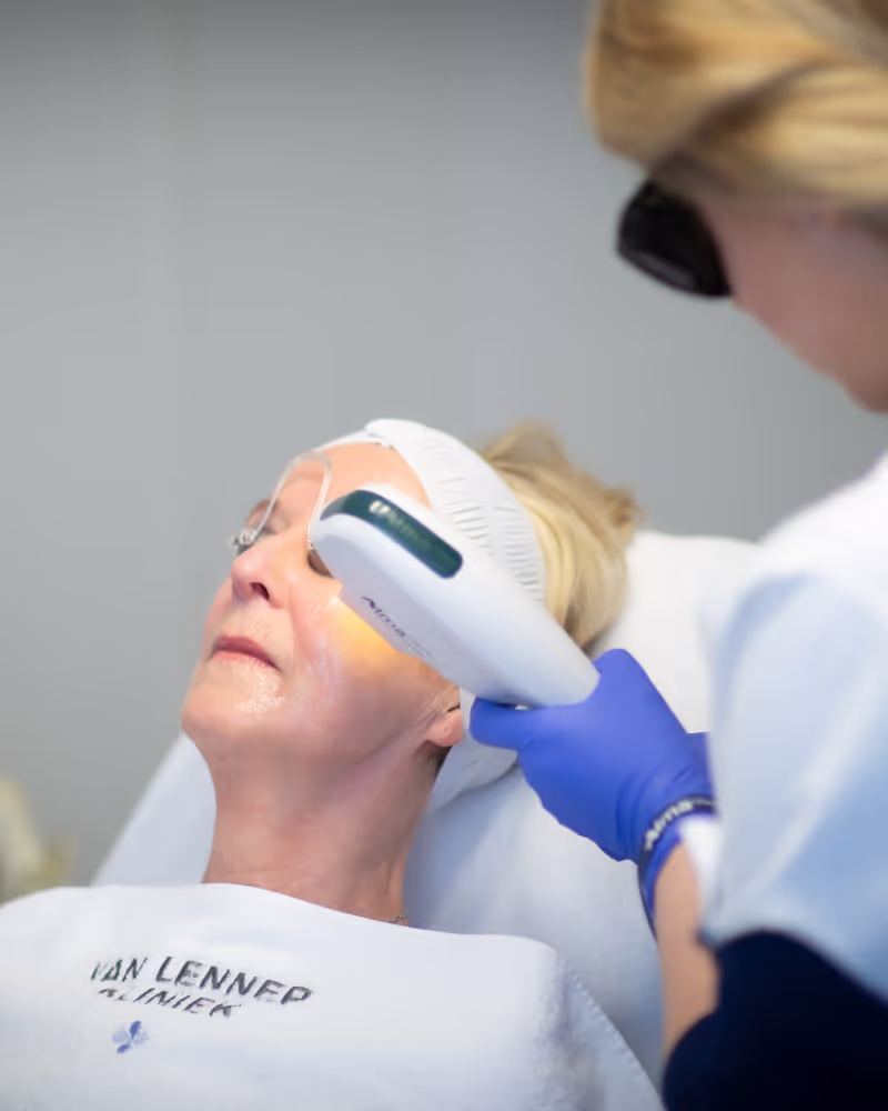LASERBEHANDELINGEN