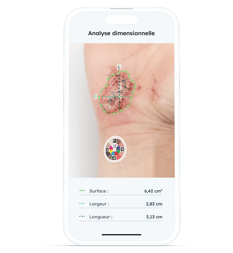 Mock-up der Messung einer Fläche auf der Pixacare-Anwendung