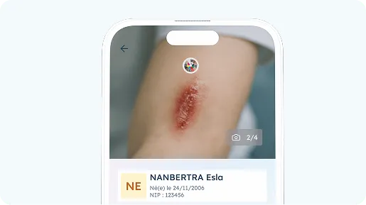 view of a scar being photographed by the Pixacare application