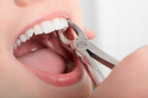 Newhall Dental, Newhall CA