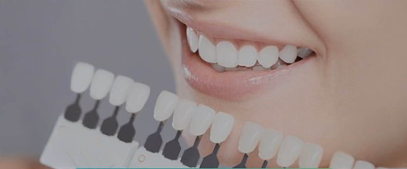 Hollywood Smile