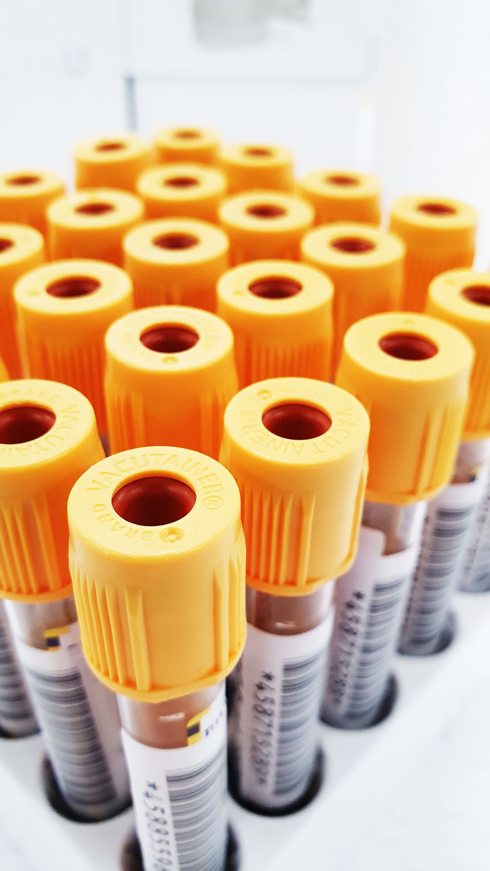 Bone Marrow Aspirate Concentrate (BMAC) Therapy