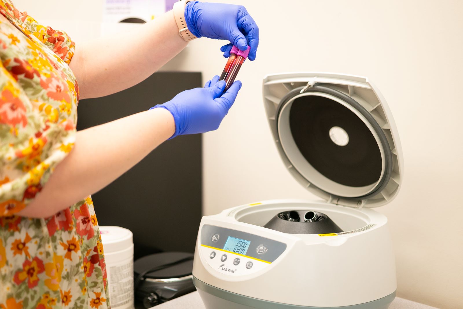 Platelet-Rich Plasma (PRP) Therapy