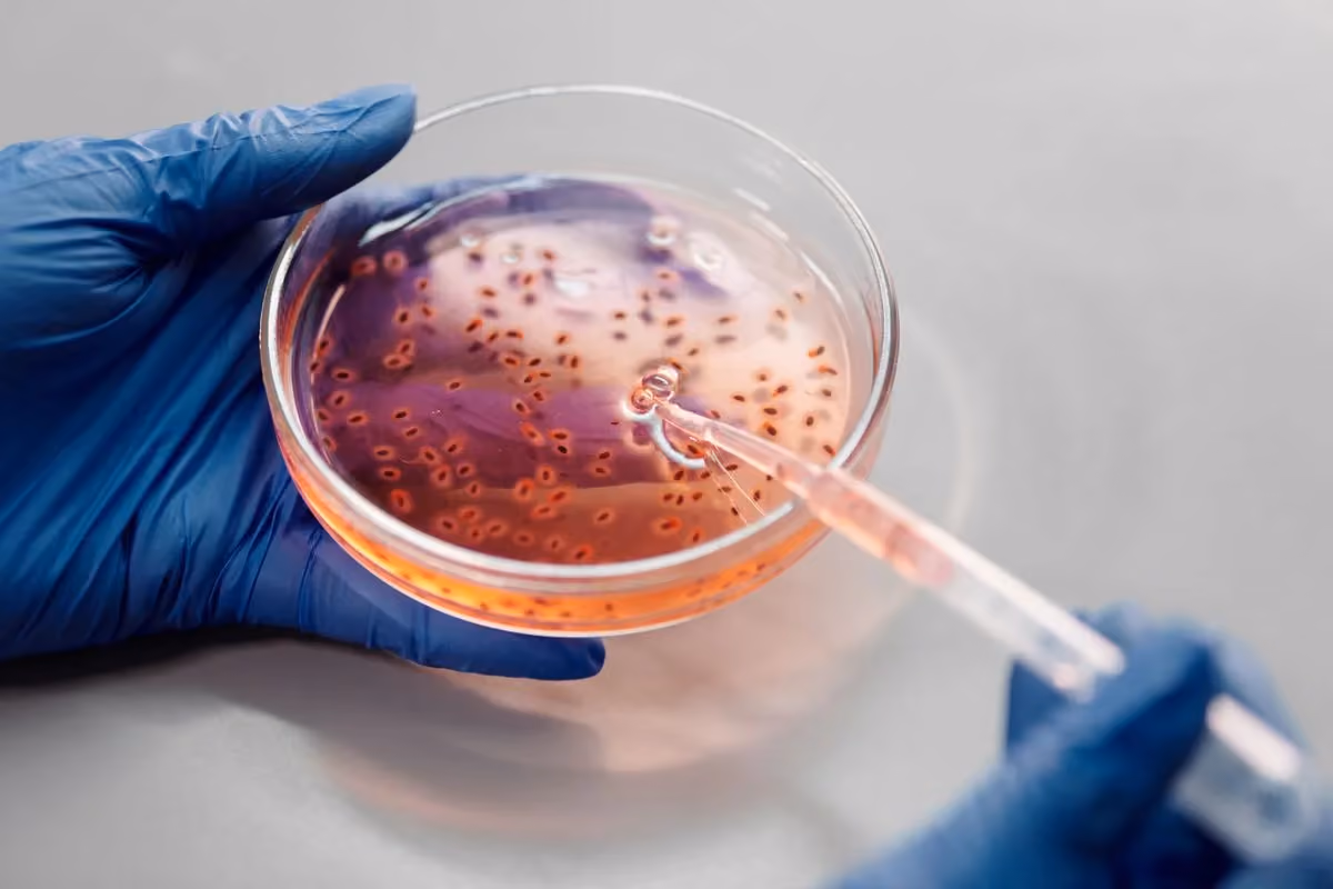 In Vitro Fertilization (IVF)