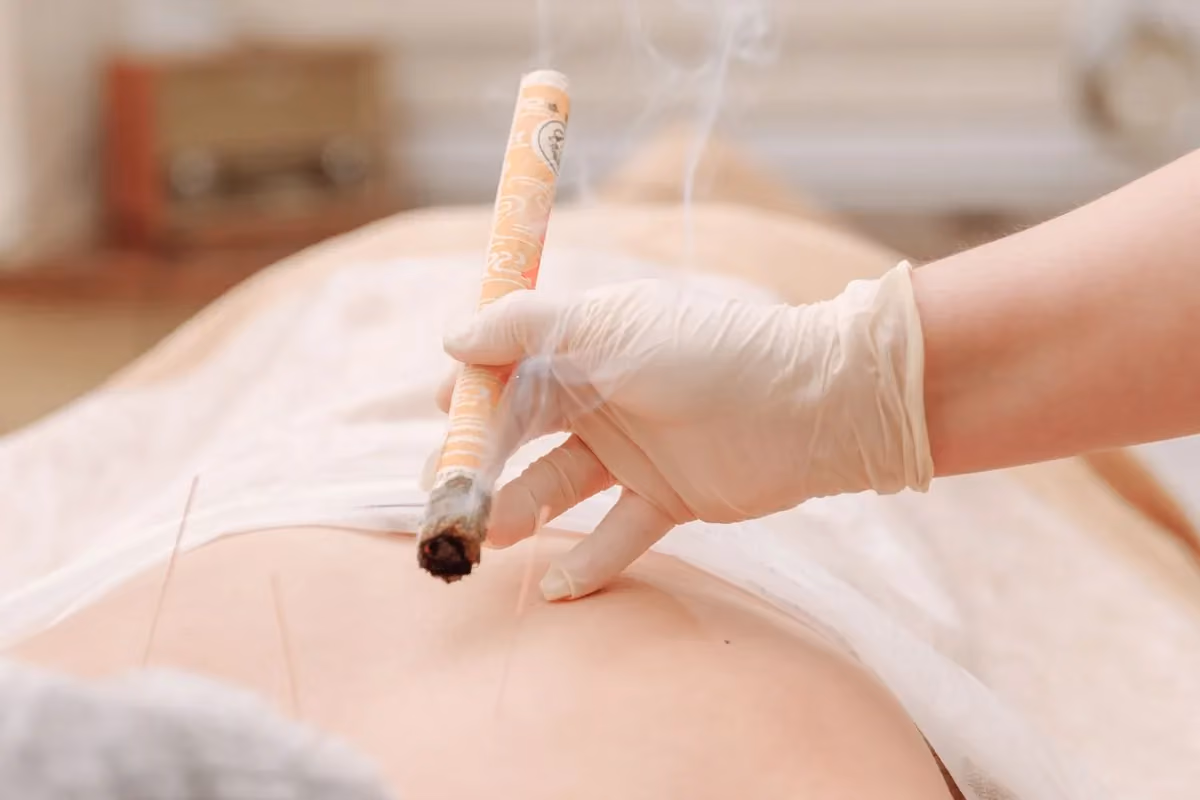 Moxibustion