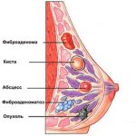 mammae груди Олівія Запоріжжя