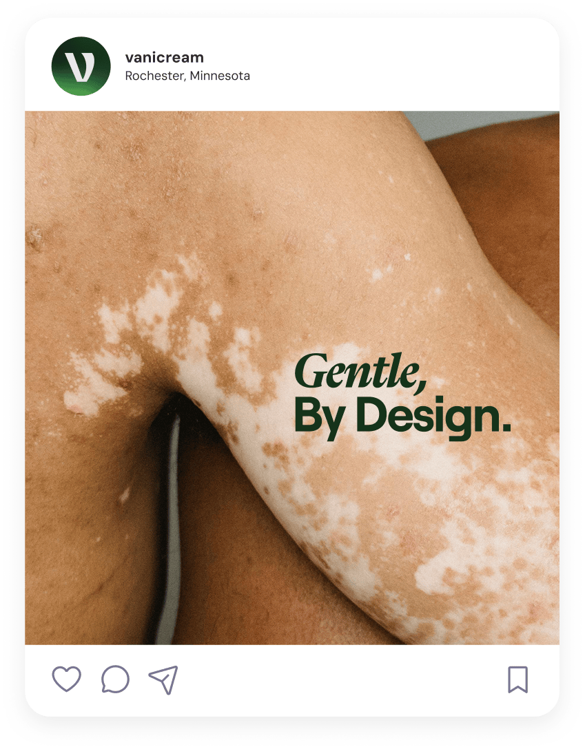 Close-up of arm with vitiligo skin condition showing patches with text 'Gentle, By Design.'