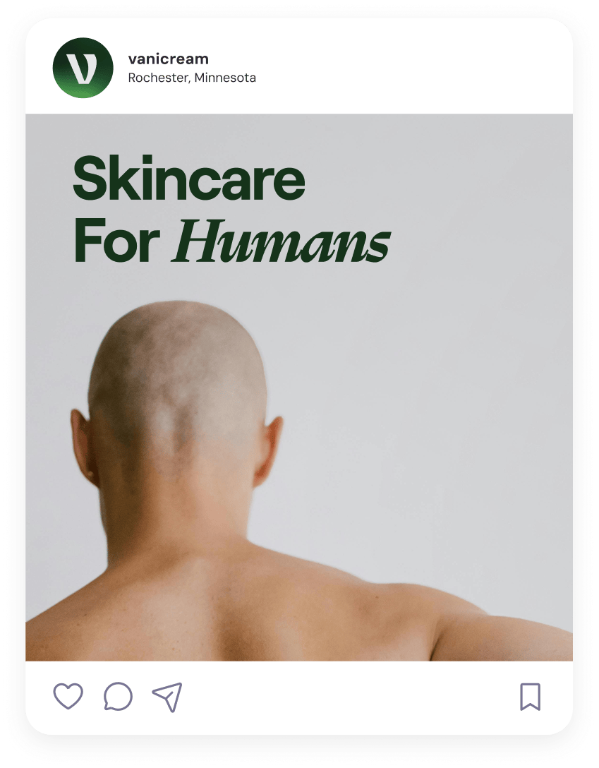 Back view of a bald person with text Skincare For Humans in dark green on a light gray background.