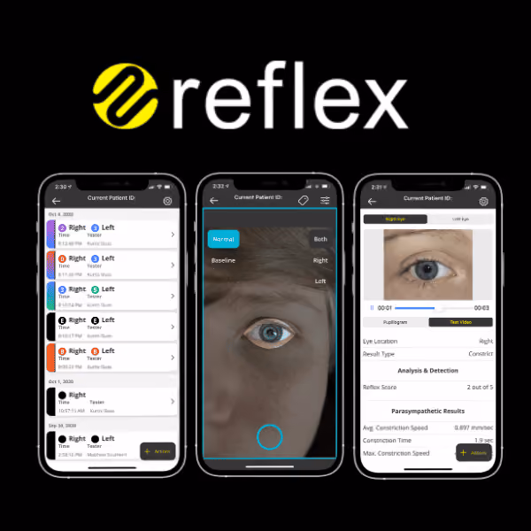 Reflex Pro