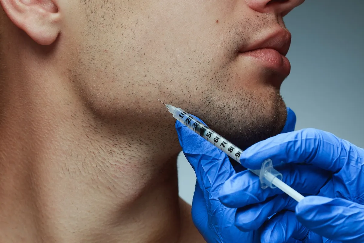 man receiving an injection in the chin area for chin filler service from newday medspa jacksonville