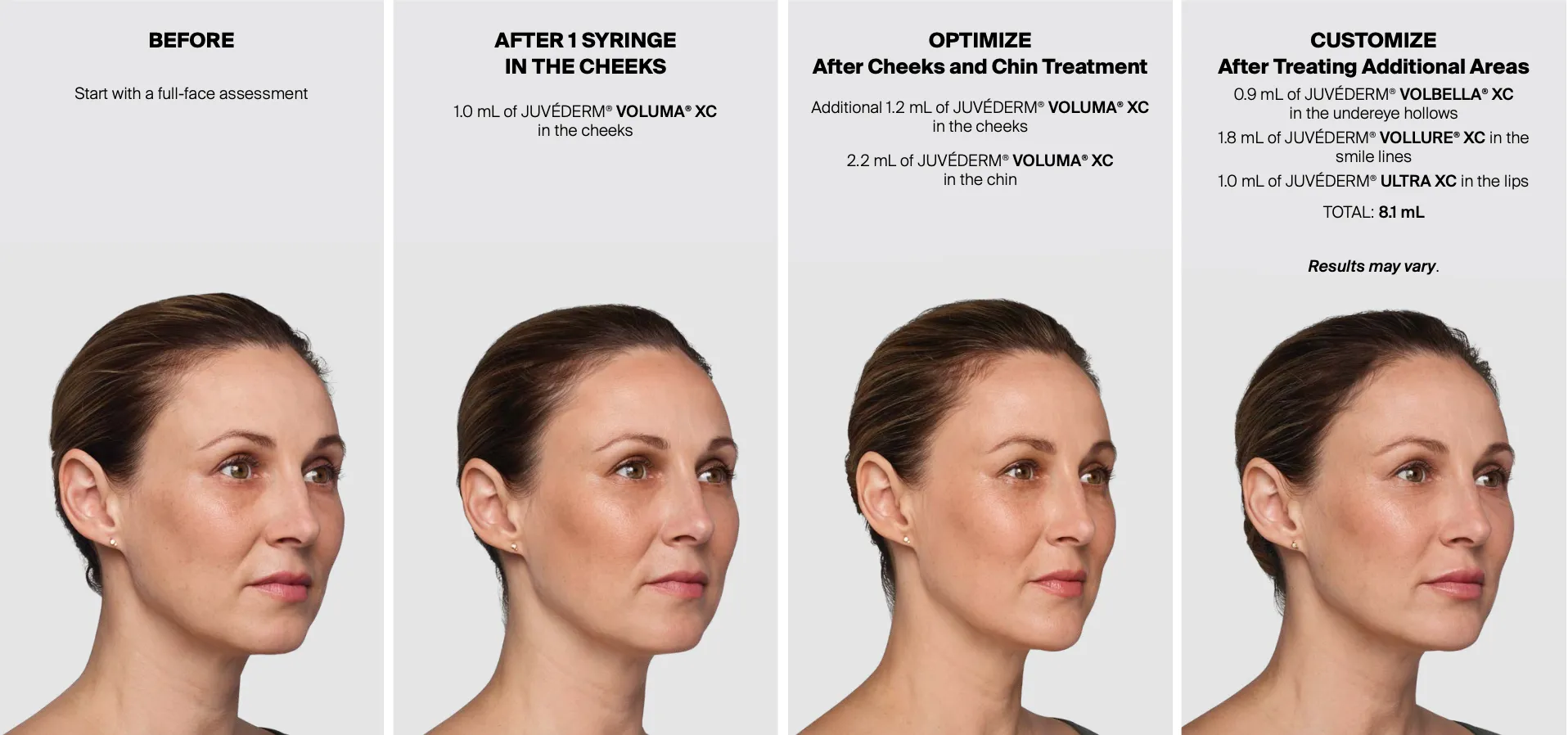 Before and after image for dermal filler service by newday medspa jacksonville