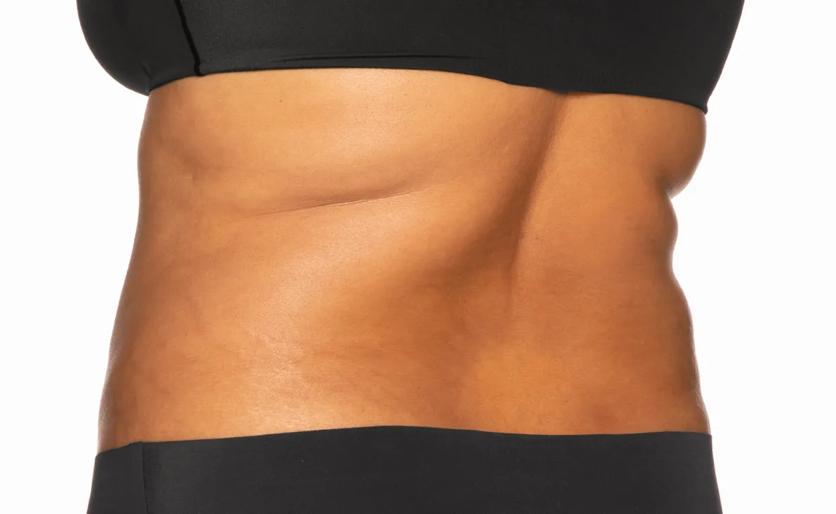 Cool Sculpting offer by new day medspa jacksonville florida	