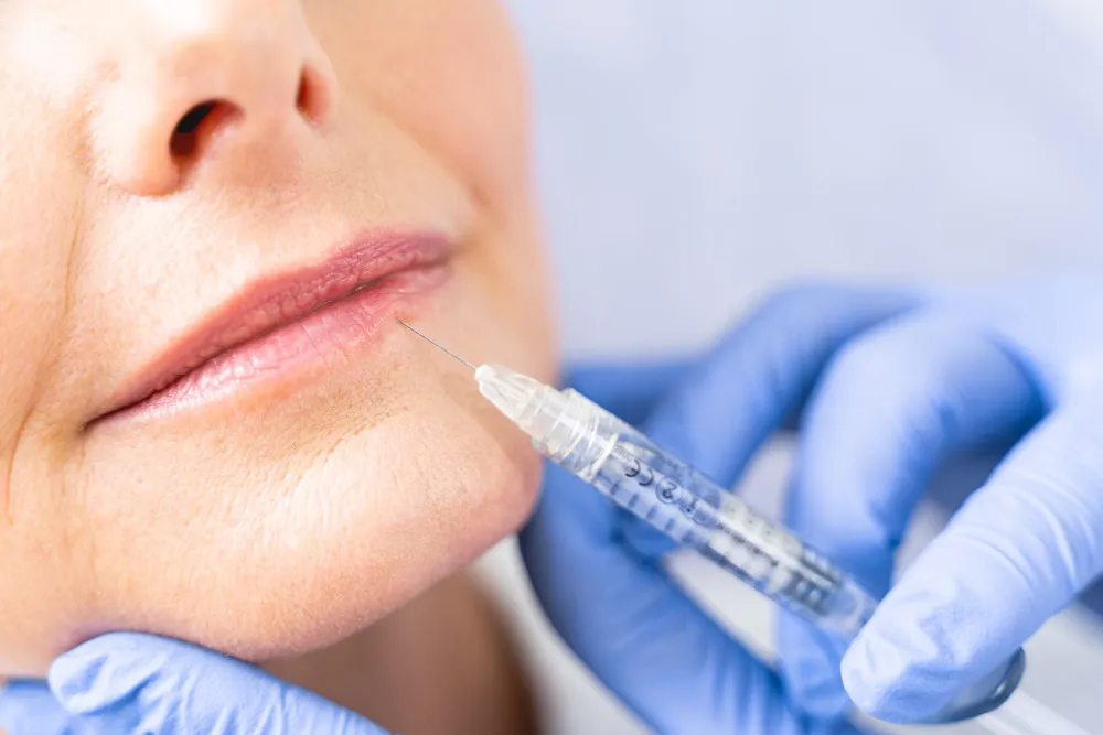 person receiving a cosmetic injection in the lip area for lip filler