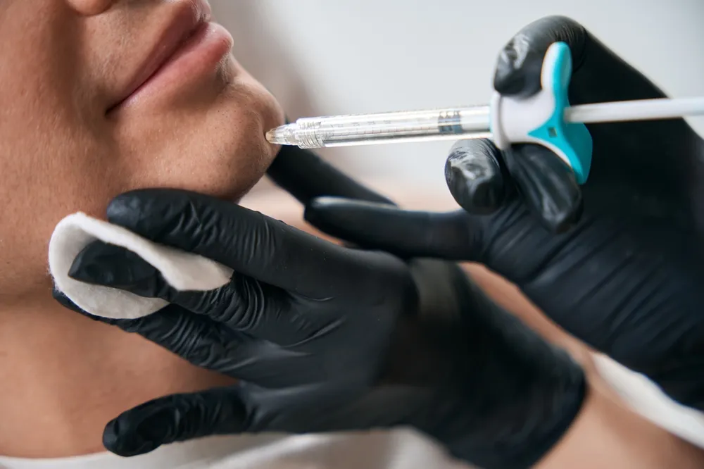 Chin filler treatment at New Day Medspa