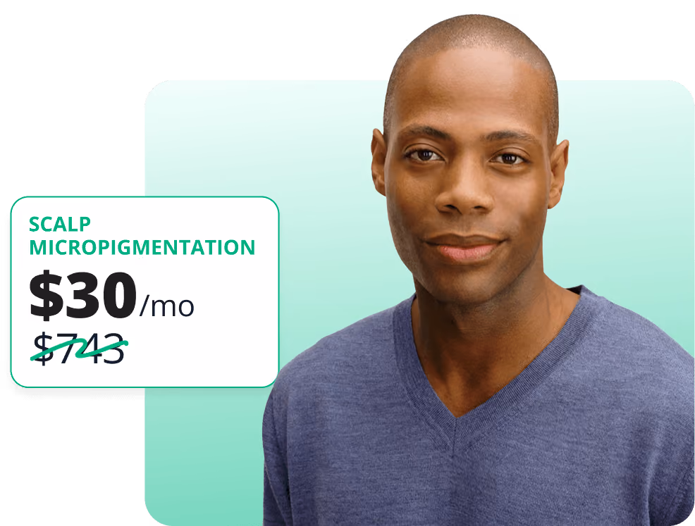 Smiling man with closely shaved hair next to text offering scalp micropigmentation for $30 per month, discounted from $743.