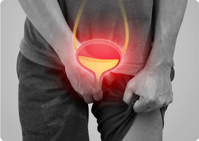 Bladder Botox® Therapy