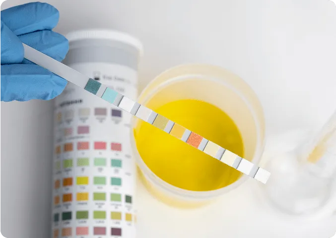 Comprehensive evaluation for recurrent infections