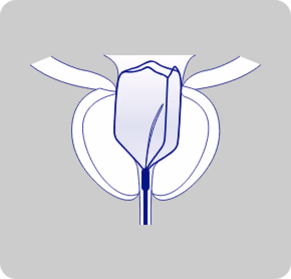 Expanded After 5 Days