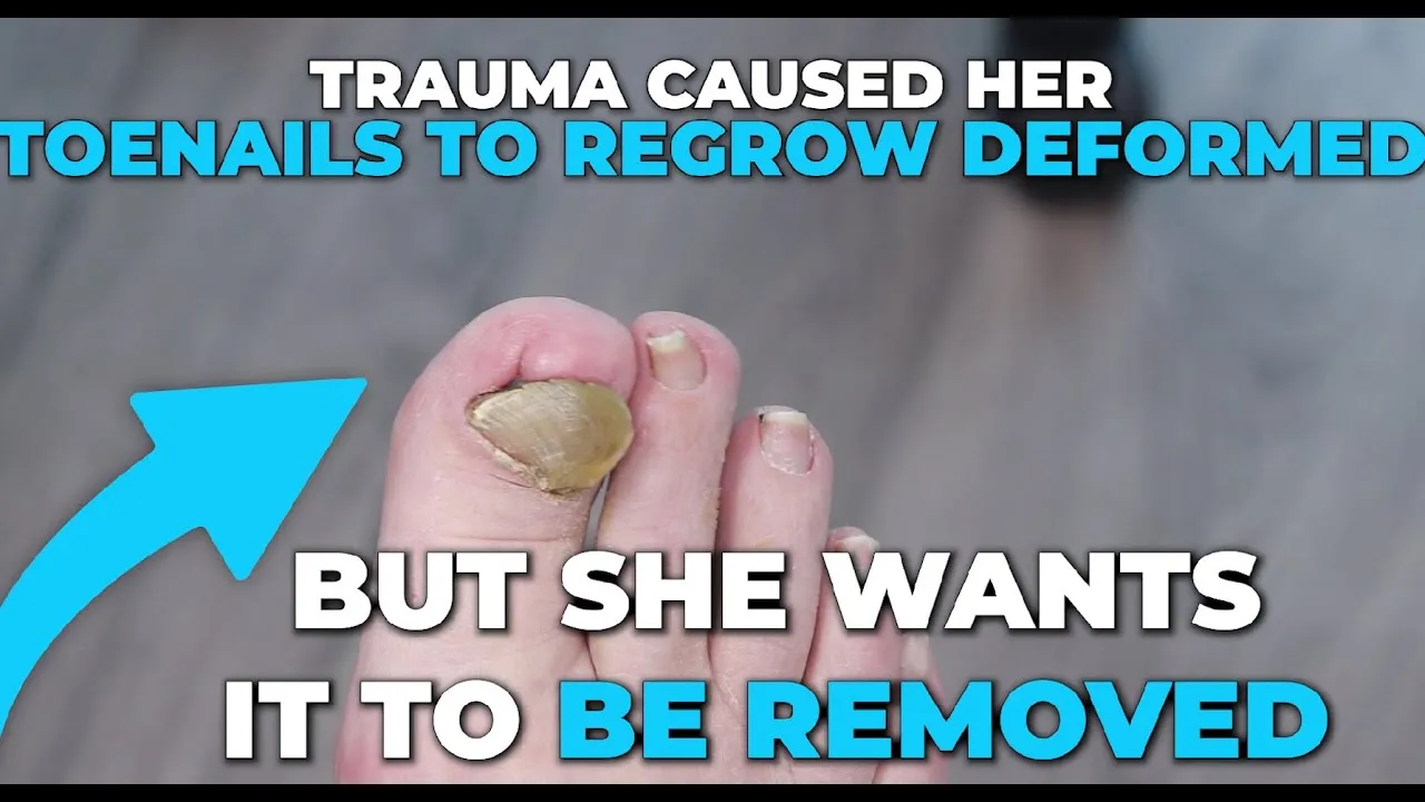 Her toenail is traumatized and regrows deforemed.