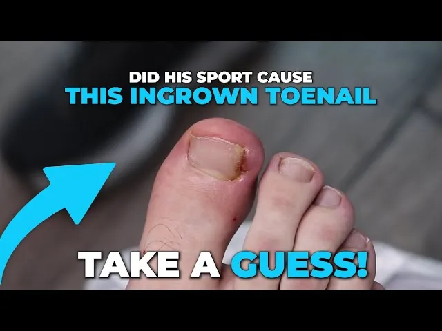 Wearing proper sports footwear helps a lot!