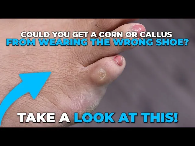 This is why wearing proper footwear is important