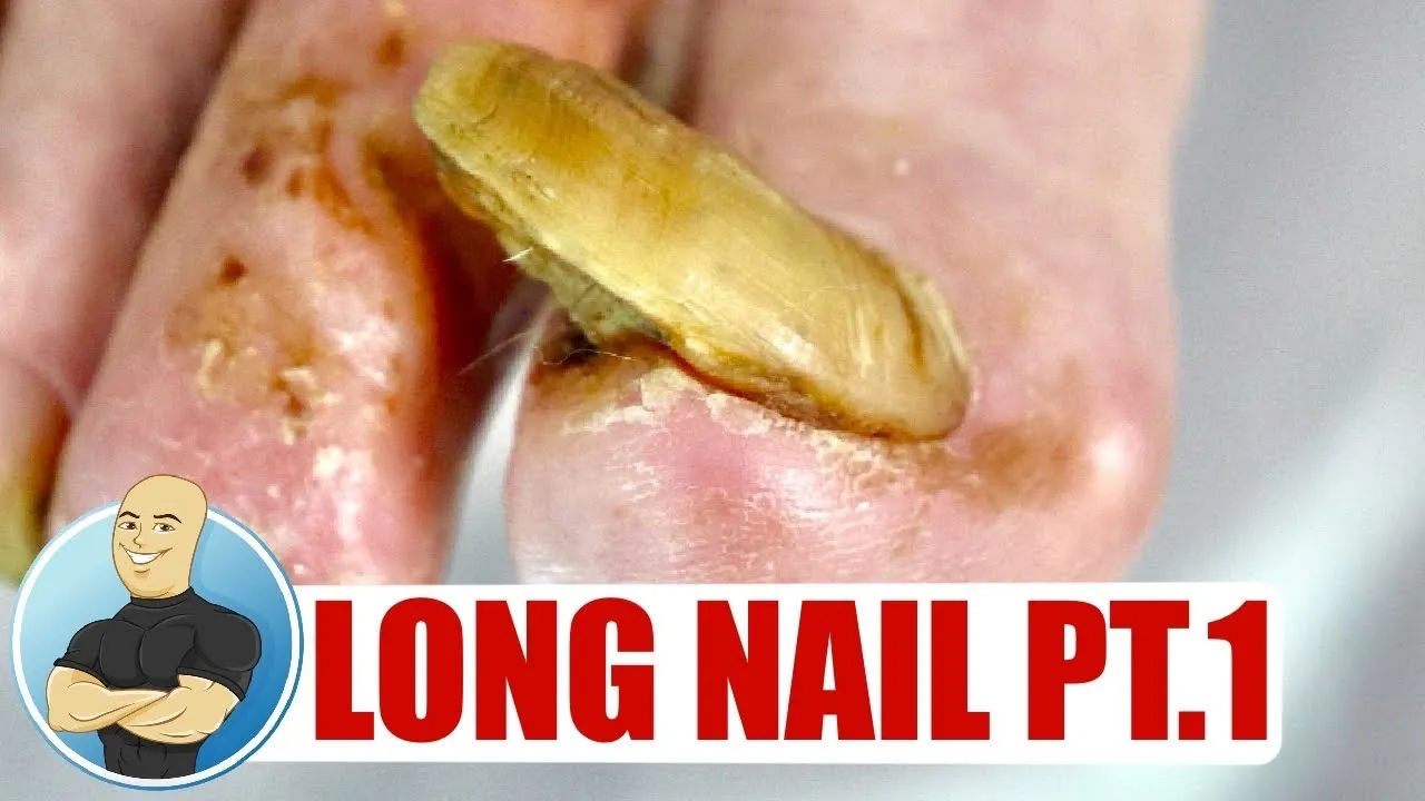 Toenail cutting of a super long nail!!! Part(1)