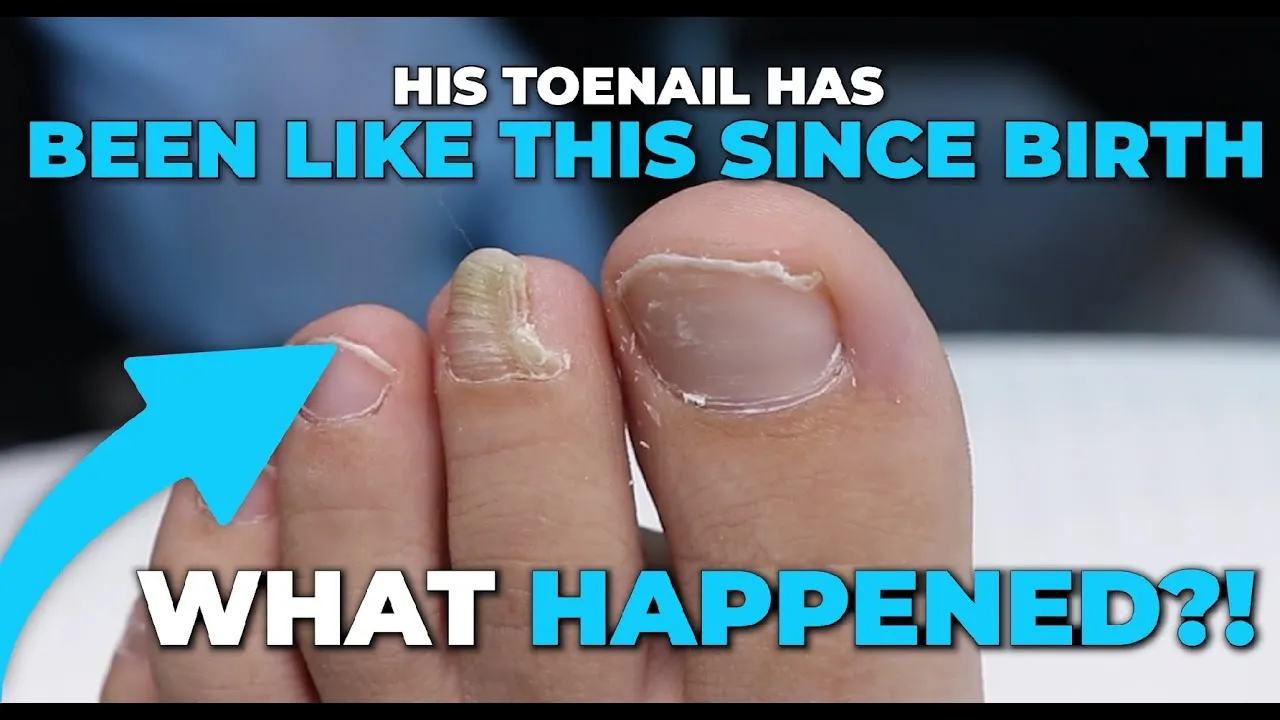 This kid needed that trimming