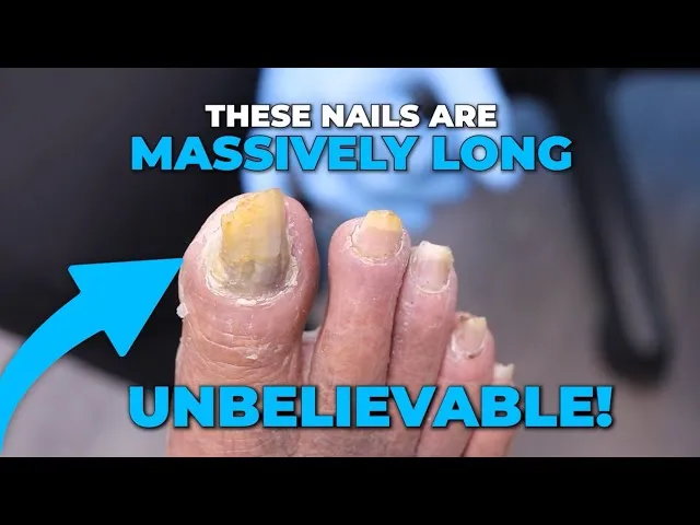 What Happened to Her Thick Toenails?! 😳